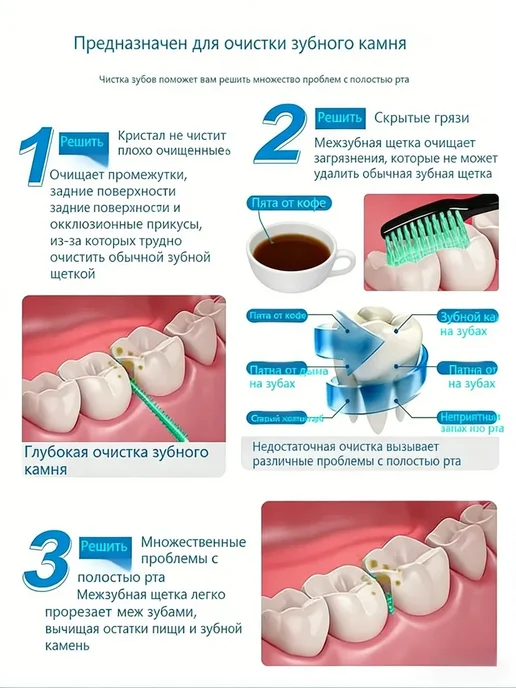 Межзубные ершики для брекетов 0.4 мм, зеленые, 200, зеленый, фото 6