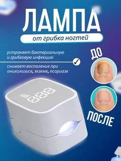Лампа от грибка ногтей, от онихолизиса, с таймером