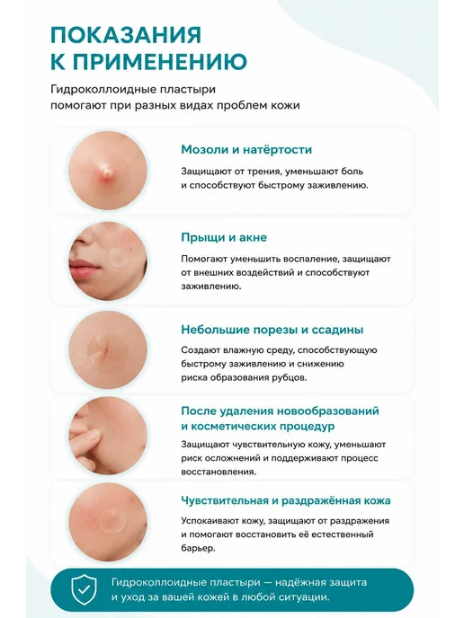 Гидроколлоидный пластырь от влажных мозолей 3смх6см 10 штук, вариант, фото 6