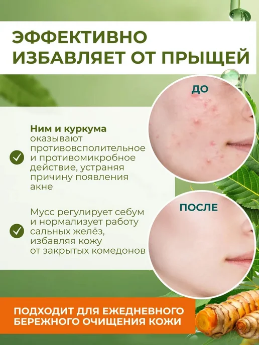 Мусс пенка для умывания лица от прыщей, вариант, фото 3