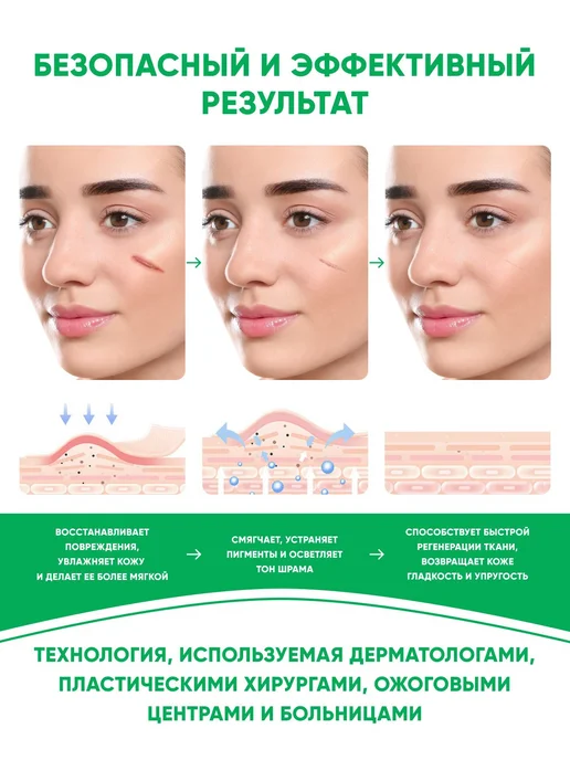 Силиконовый пластырь от шрамов и рубцов рулон 2,5 см х 300 с, вариант, фото 2