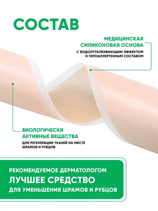 Силиконовый пластырь от шрамов и рубцов рулон 2,5 см х 300 с, вариант, фото 6