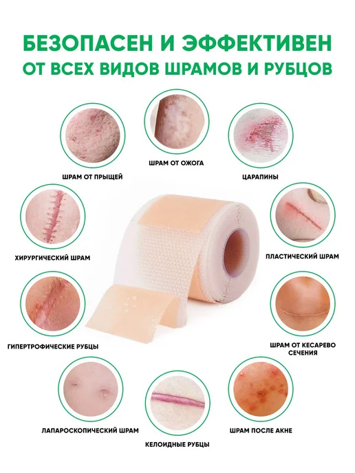 Силиконовый пластырь от шрамов и рубцов рулон 2,5 см х 300 с, вариант, фото 7