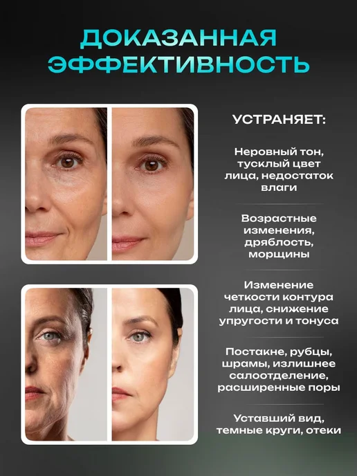 Микротоковый массажер для лица MC-5, rf лифтинг аппарат, мик, вариант, фото 2