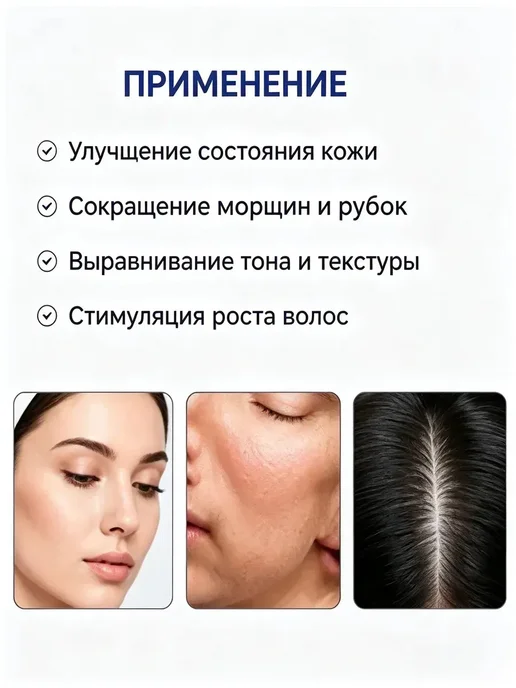 Иглы для косметологического аппарата, вариант, фото 7